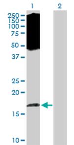 EIF5A2 Polyclonal Antibody, MaxPab™