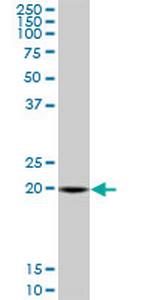 SAR1A Antibody in Western Blot (WB)