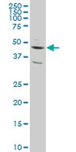 SLC2A4RG Antibody in Western Blot (WB)
