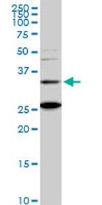 BARHL1 Monoclonal Antibody (2B11)