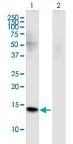 FMN2 Monoclonal Antibody (4B8)