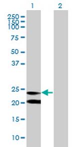 C15orf24 Polyclonal Antibody, MaxPab™