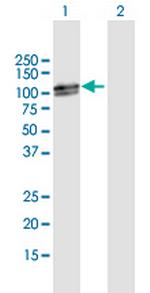 RAD18 Polyclonal Antibody, MaxPab™
