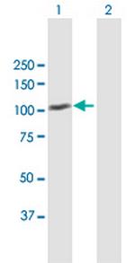 MDM1 Antibody in Western Blot (WB)