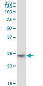 BDH2 Polyclonal Antibody, MaxPab™