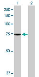 PAK6 Antibody in Western Blot (WB)