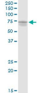 PAK6 Antibody in Western Blot (WB)