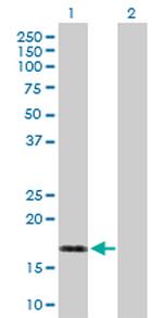 DUSP22 Antibody in Western Blot (WB)