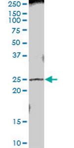 PRTFDC1 Polyclonal Antibody, MaxPab™