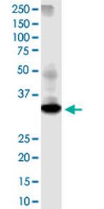 DTWD1 Monoclonal Antibody (2E6)