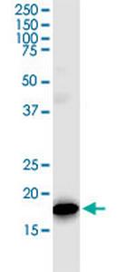 TOMM22 Monoclonal Antibody (4G4)