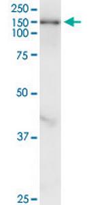 TULP4 Monoclonal Antibody (7B7)