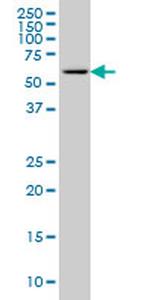 CABC1 Antibody in Western Blot (WB)