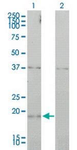 CCNL1 Monoclonal Antibody (1F7-1C5)