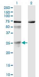 TWSG1 Monoclonal Antibody (6E6)
