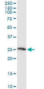 TWSG1 Monoclonal Antibody (2F3)
