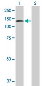 DDX24 Polyclonal Antibody, MaxPab™