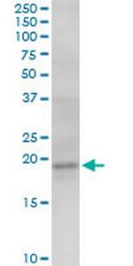 AGTRAP Antibody in Western Blot (WB)