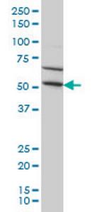 TRIM49 Monoclonal Antibody (3H8)