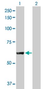 PNPLA2 Antibody in Western Blot (WB)