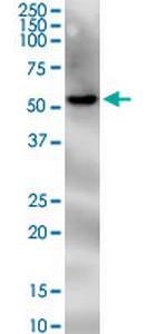 PNPLA2 Monoclonal Antibody (2H1)