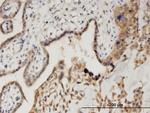 CAMK1D Antibody in Immunohistochemistry (Paraffin) (IHC (P))