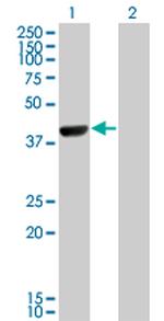 CAMK1D Antibody in Western Blot (WB)