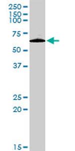 PLXDC1 Antibody in Western Blot (WB)