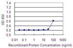 ADCK1 Monoclonal Antibody (4B10)
