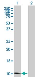 SLURP1 Antibody in Western Blot (WB)