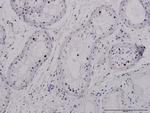 SALL4 Monoclonal Antibody (6E3)
