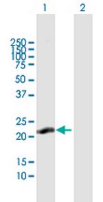 C13orf1 Antibody in Western Blot (WB)