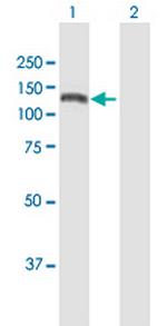 KIAA1199 Antibody in Western Blot (WB)