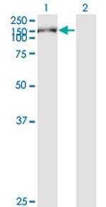 KIAA1199 Antibody in Western Blot (WB)