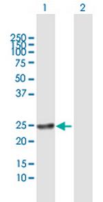 RAB22A Polyclonal Antibody, MaxPab™