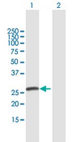 SPBC25 Antibody in Western Blot (WB)