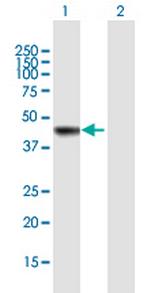 AS3MT Antibody in Western Blot (WB)