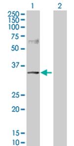 NDRG2 Antibody in Western Blot (WB)