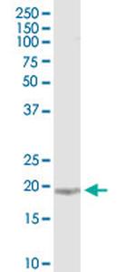 KIAA1143 Monoclonal Antibody (4E11)