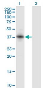 RNF150 Monoclonal Antibody (5D11)