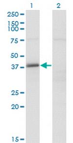 FAM62B Antibody in Western Blot (WB)