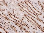 ARID1B Antibody in Immunohistochemistry (Paraffin) (IHC (P))