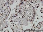 ARID1B Antibody in Immunohistochemistry (Paraffin) (IHC (P))