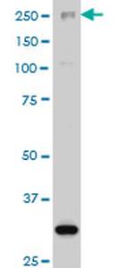 ARID1B Antibody in Western Blot (WB)