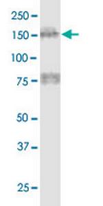 MTUS1 Monoclonal Antibody (1C7)