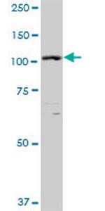 XPO5 Polyclonal Antibody, MaxPab™
