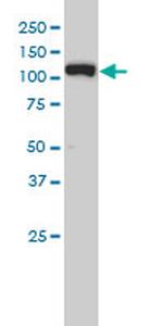 XPO5 Antibody in Western Blot (WB)