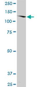 SORCS2 Monoclonal Antibody (1D7)
