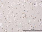 ALPK3 Antibody in Immunohistochemistry (Paraffin) (IHC (P))
