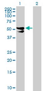 PDP2 Polyclonal Antibody, MaxPab™